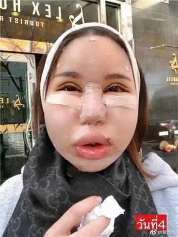 河南整容的一个网红,引发网友热议